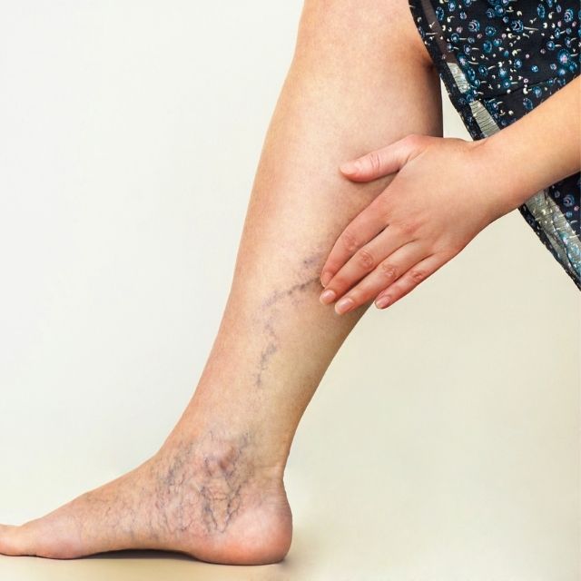 MIS Laparoscopic Surgery