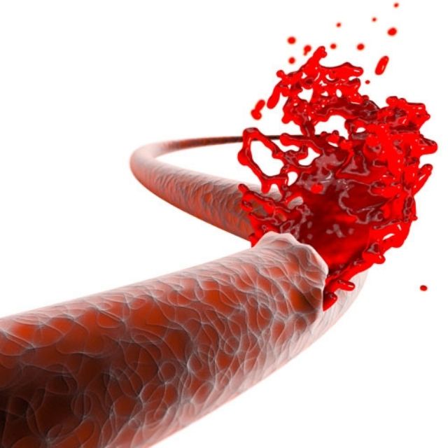 weight loss management in delhi