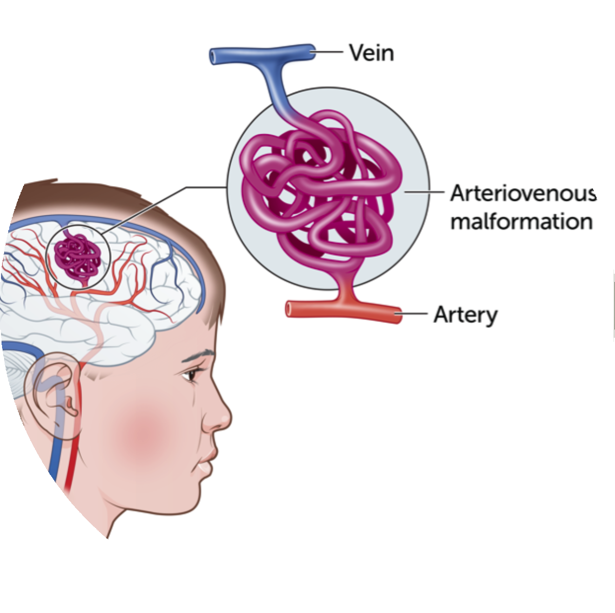 hernia surgery treatment in delhi noida